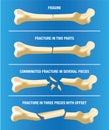 Anatomy various skeletal bone fractures