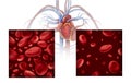 Anemia Anaemia Concept Diagram