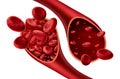 Anemia Anatomy