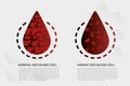 Anemia Iron red blood cell medical vector illustration medical.