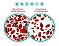 Anemia level of blood cells