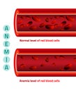 Anemia level of blood cells