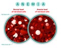 Anemia level of blood cells