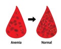 Anemia and normal ammount of red blood cells Royalty Free Stock Photo