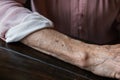 Anf elderly woman grandmother& x27;s arm with wrinkles and age spots.