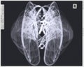 Angel Wings X-ray Version Royalty Free Stock Photo