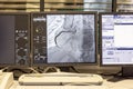 Angiogram sequence working clockwise using x-rays with a contrast agent injected from a tube inserted into the arteries (left &