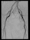 Angiography of the pelvis region