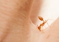 Angry ant attack by bite and spray citric acid Royalty Free Stock Photo