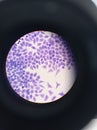 Animal eucariotic cells. HeLa cells view with an optic microscope.