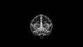 Animated 3d model of human brain rotating over black background and pulsing electrical brainwaves.