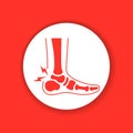 Ankle arthritis glyph color icon. Inflammation joint.