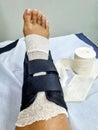 ankle ligament rupture being immobilized Royalty Free Stock Photo