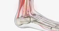 Ankle sprains are classified based on the amount of damage to the ligament