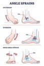 Ankle sprains situations with inversion and eversion injury outline diagram Royalty Free Stock Photo