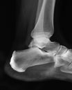 Ankle X-ray Royalty Free Stock Photo
