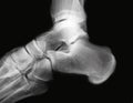 Ankle x-ray Royalty Free Stock Photo