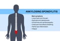 Ankylosing spondylitis disease