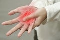 Anonymous person touching her wrist, suferring from arthritis disease