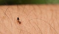 Ant attack biting Royalty Free Stock Photo