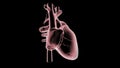 Anterior myocardial ischemia