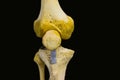 Antero posterior view of articulated femur tibia fibula patella bones showing human knee joint anatomy in isolated black backgroun