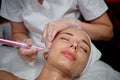 Anti-aging care with dermapen, patient face close-up