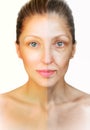 Anti-aging procedure before and after