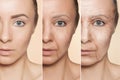 Anti-aging procedures on caucasian woman face Royalty Free Stock Photo