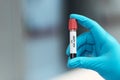 Anti HIV laboratory test