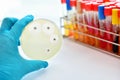 Antimicrobial susceptibility test Royalty Free Stock Photo