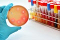 Antimicrobial susceptibility test Royalty Free Stock Photo