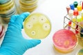 Antimicrobial susceptibility testing