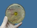 Antimicrobial susceptibility testing in petri dish. Royalty Free Stock Photo