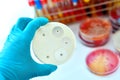 Antimicrobial susceptibility testing in petri dish