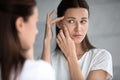 Anxious young woman look in mirror worried about face acne