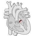 Aortic valve - Heart - Human body - Education Royalty Free Stock Photo