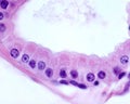 Apocrine sweat gland. Columnar epithelium