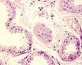 Apocrine sweat gland. Columnar epithelium