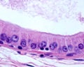 Apocrine sweat gland. Columnar epithelium