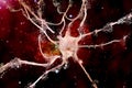 Apoptosis of neuron which is observed in different diseases Royalty Free Stock Photo