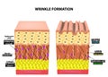 The appearance of wrinkles. Anatomical structure of the skin. Elastin, Hyaluronic acid, Collagen. Infographics. skin