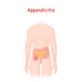 Appendicitis. human silhouette with a colon, small intestine and an inflamed appendix