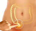 The appendix is a finger-like, blind-ended tube connected to the cecum. The cecum is a pouch-like structure of the colon