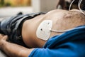 Application of defibrillation electrodes