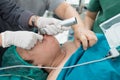 Apply laryngoscope for insert endotracheal tube Royalty Free Stock Photo