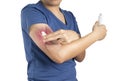 Apply painkillers to arm , arm muscle pain from inflammation