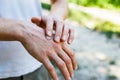 Applying an cream emollient to dry flaky skin as in the treatment of psoriasis, eczema and other dry skin conditions Royalty Free Stock Photo