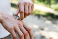 Applying an emollient to dry flaky skin as in the treatment of psoriasis, eczema and other dry skin conditions. White Royalty Free Stock Photo