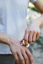 Applying an cream emollient to dry flaky skin as in the treatment of psoriasis, eczema and other dry skin conditions Royalty Free Stock Photo